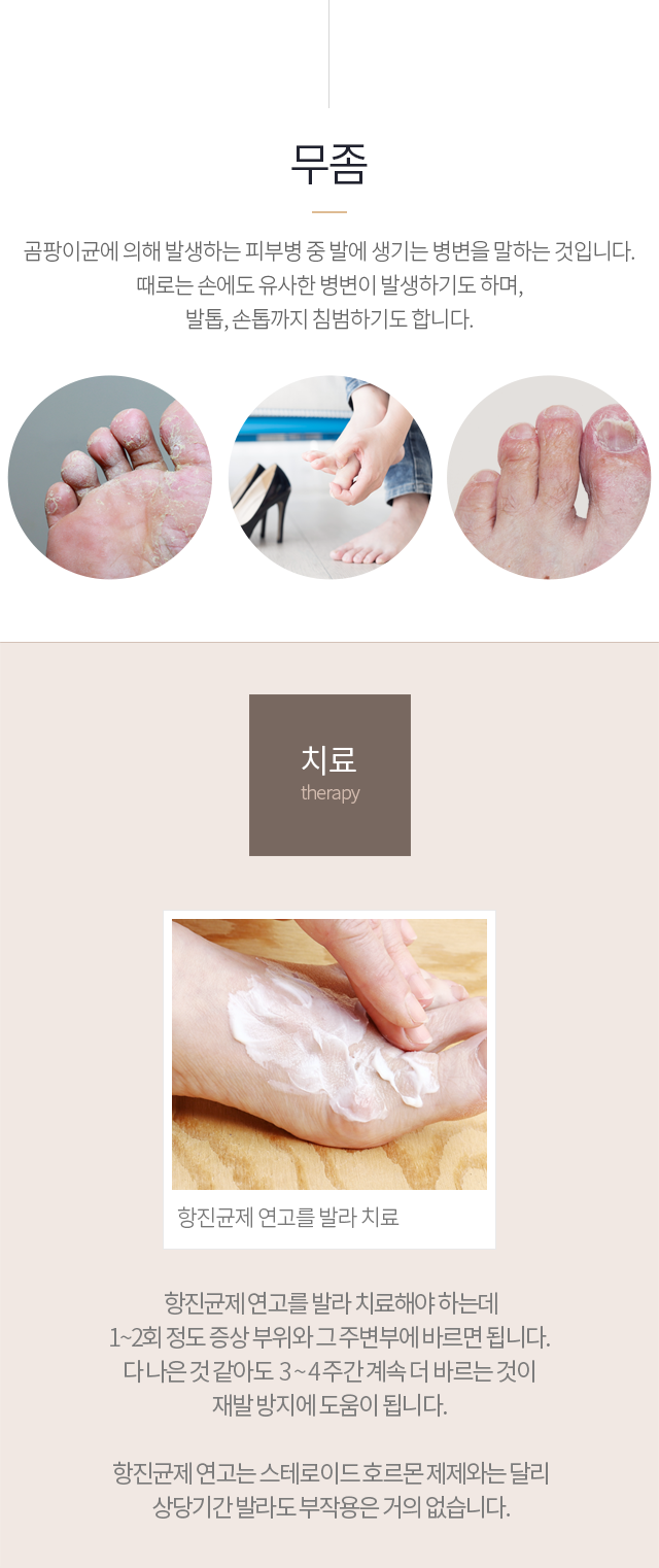 무좀